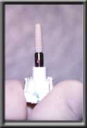 implant with carrier ready for insertion