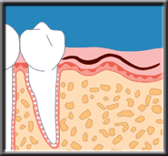 implant drawing 1