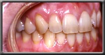 patient's oral hygiene improves image one