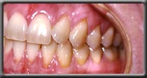 patient's oral hygiene improves image two