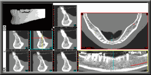 Sim/plant overview showing lower jaw